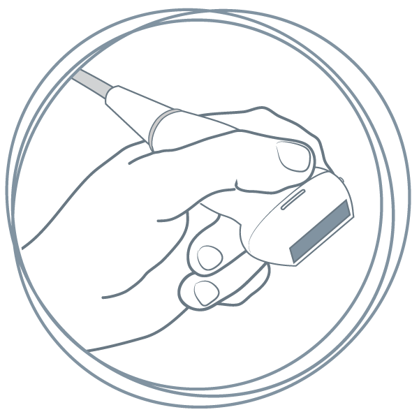 Venen-Check Venenzentrum Chiemgau