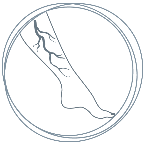 Krampfadern Venenzentrum Chiemgau